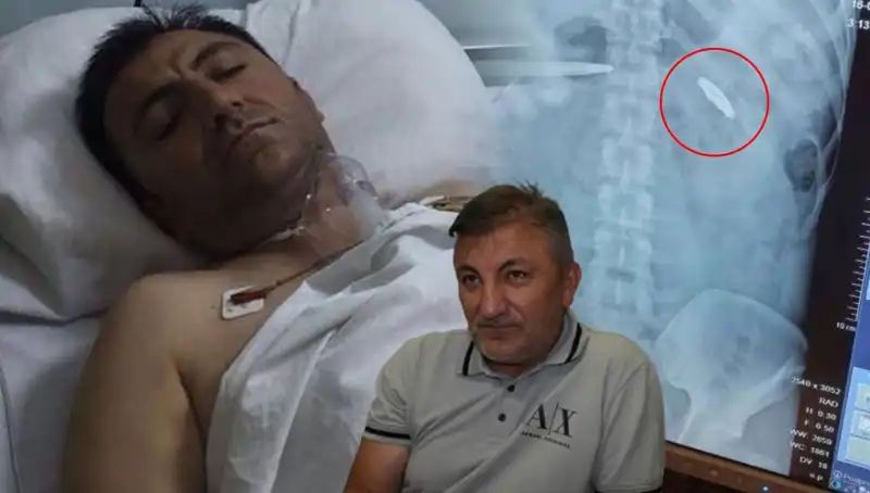 15 Temmuz'un İzleri: Vücudunda Kurşunla Taşıdığı Acı Miras