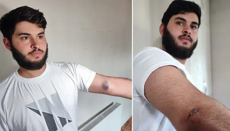 Bahçeye Kaçan Top, Mahallede Gözlerin Aydınlanmasına Neden Oldu!